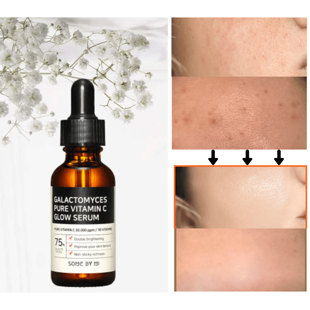 SOME BY MI - Galactomyces Pure Vitamin C Glow Serum - 30ml - YEPPEOYO.