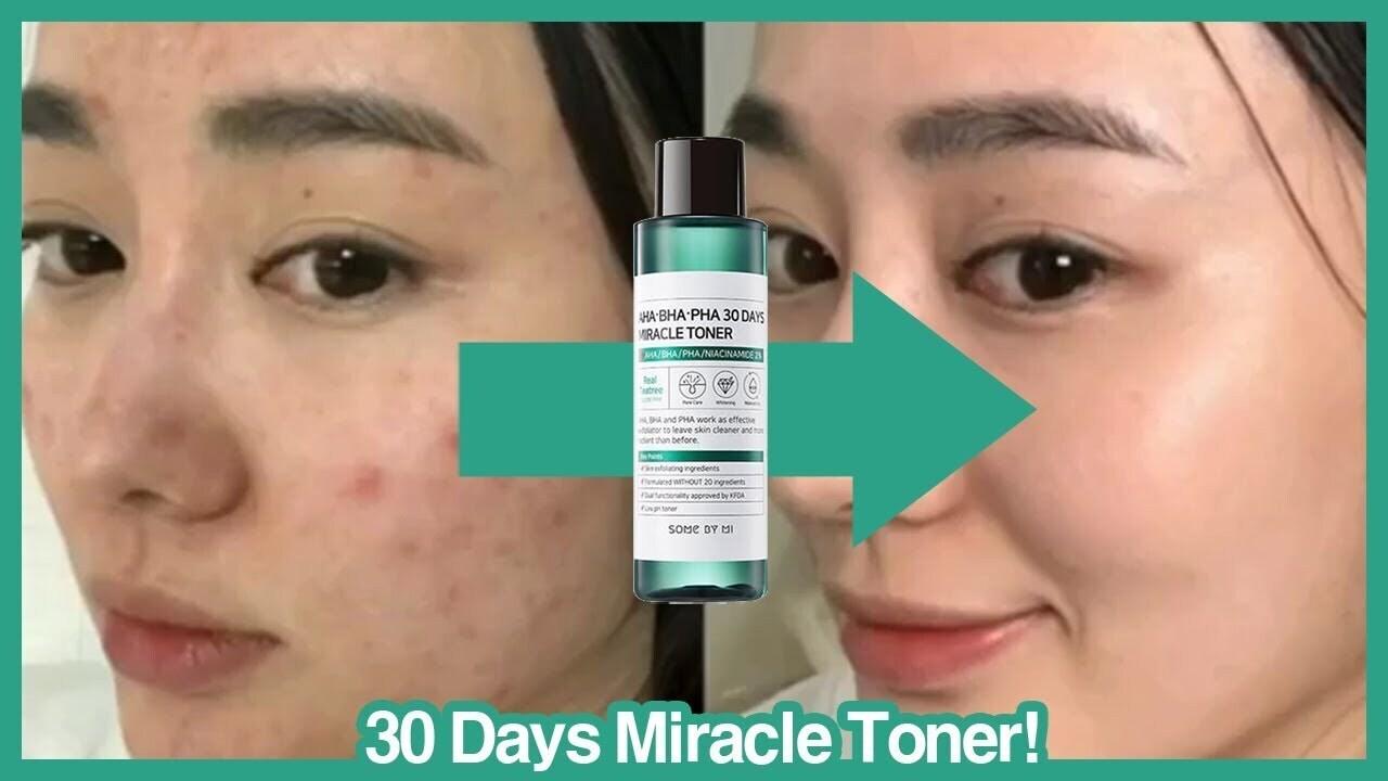 SOME BY MI - AHA-BHA-PHA 30 Days Miracle Toner - 150ml - YEPPEOYO.