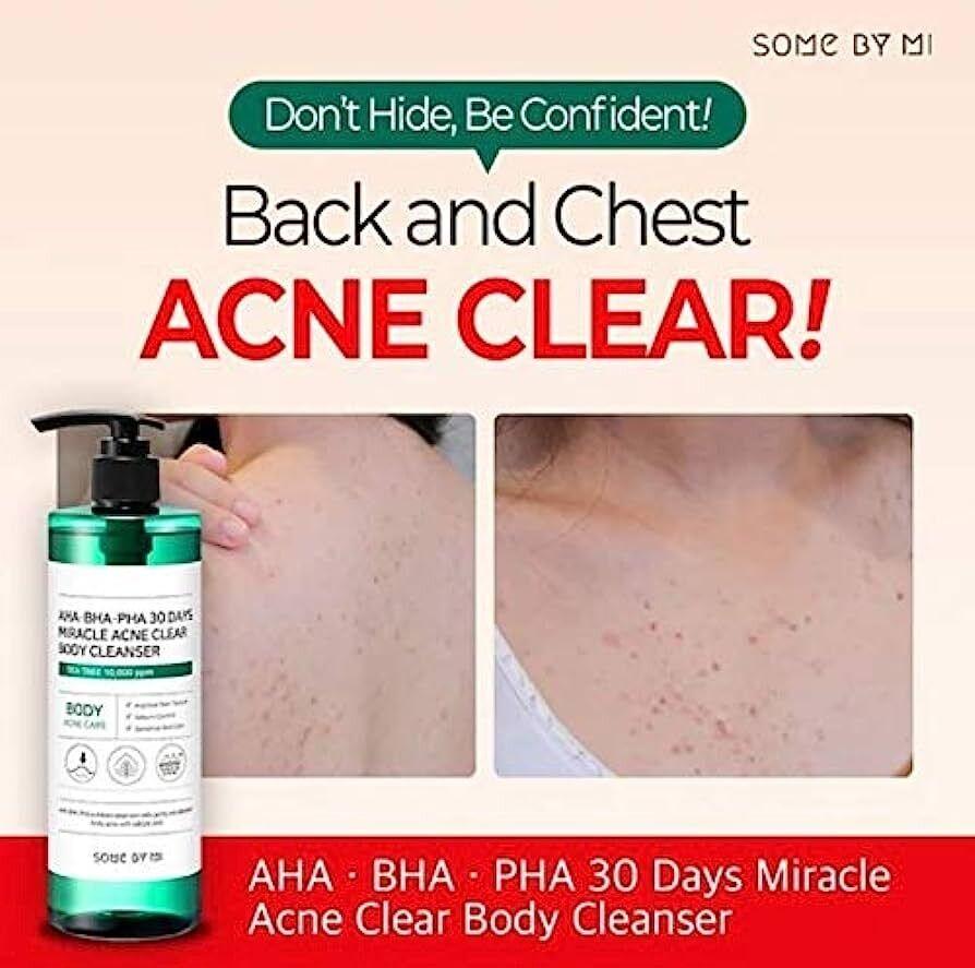 SOME BY MI – AHA, BHA, PHA 30 Days Miracle Acne Clear Body Cleanser - 400g - YEPPEOYO.